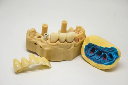 Dental models