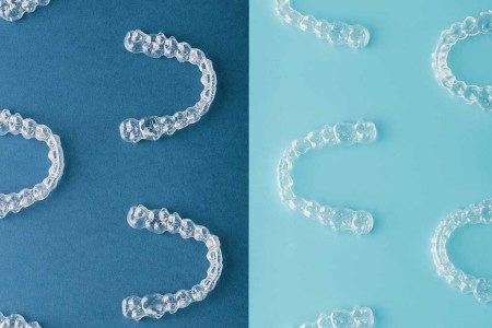 Four At-Home Aligners to Help Get Your Smile Back