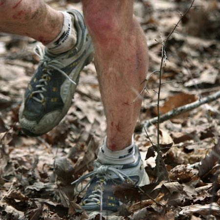 The legs of someone who attempted the Barkley Marathons.