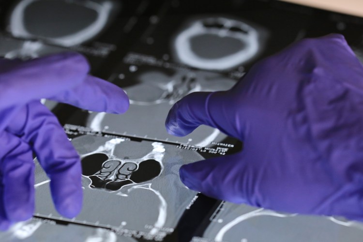 Doctor looking at an x-ray