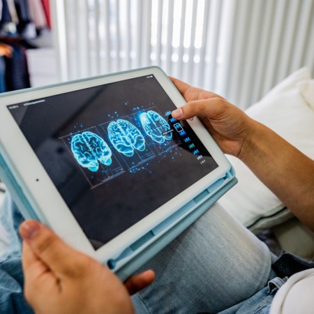 Person looking at brain scan