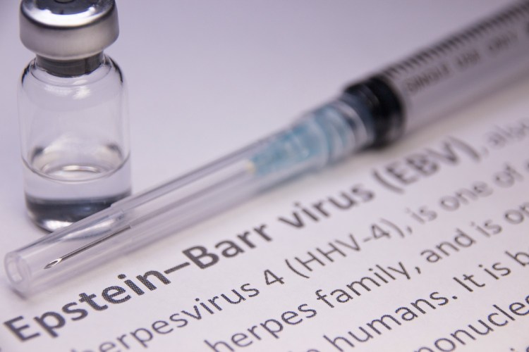 Medical tools and information on the Epstein-Barr virus.