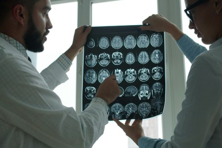Doctors looking at brain scans