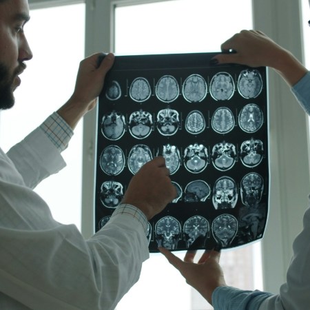 Doctors looking at brain scans